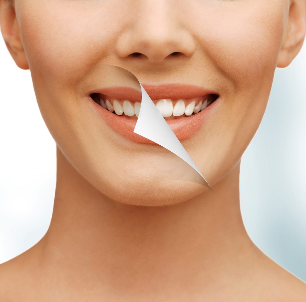 white teeth