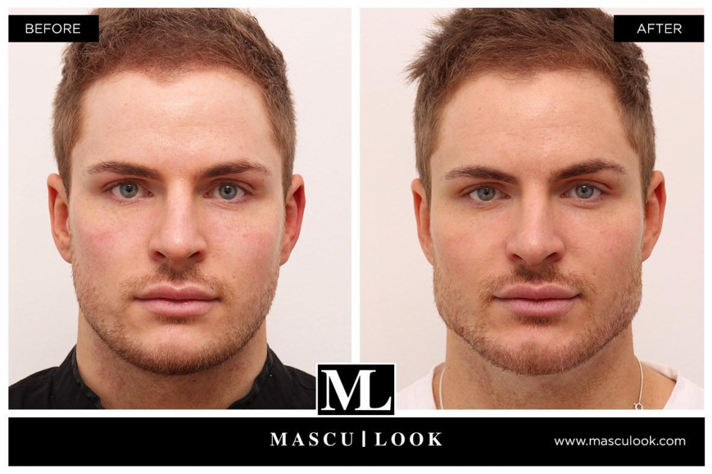 male aesthetic