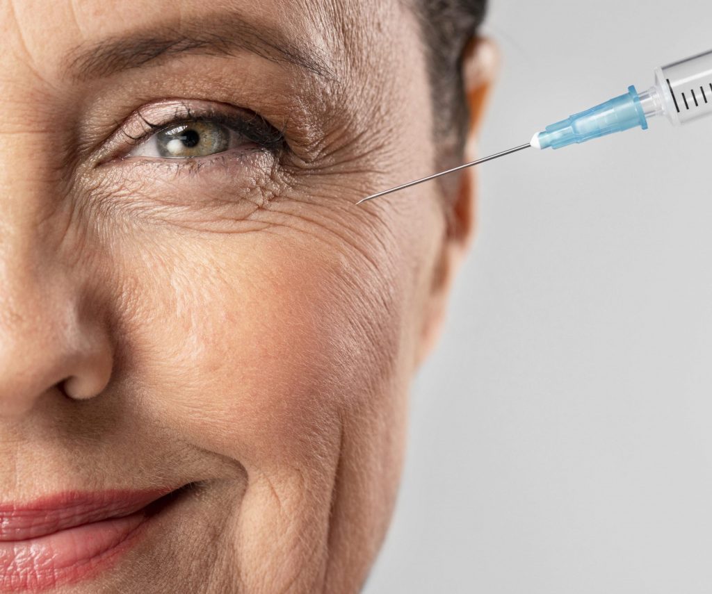 wrinkle filler