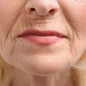 tratamiento código de barras