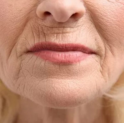 tratamiento código de barras